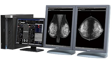 マンモグラフィー（乳房X 線検査）
